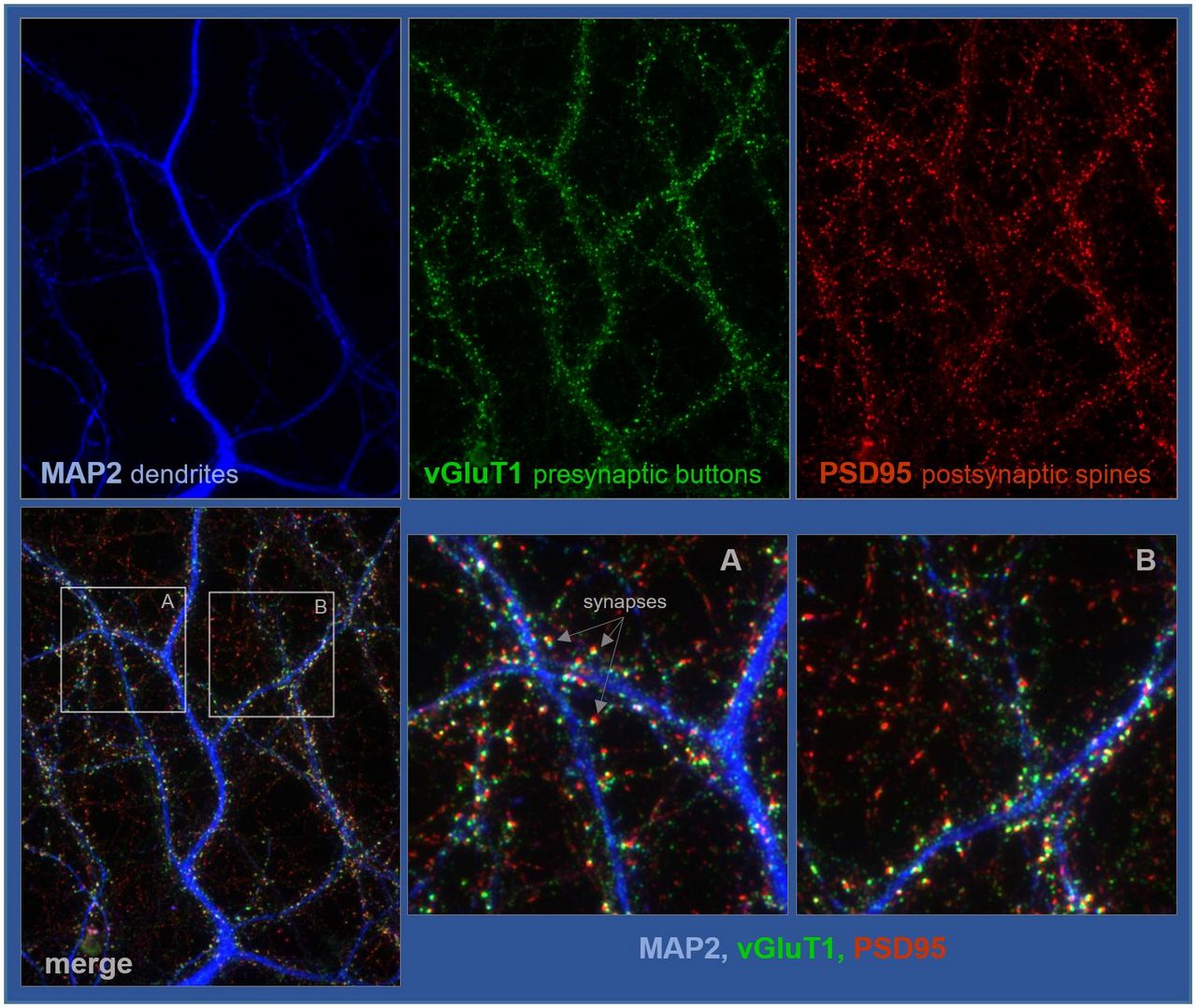 Una proteína cerebral promueve la interconectividad neuronal
