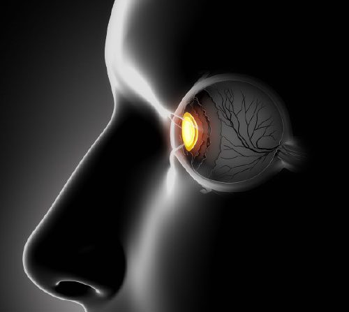 ucm ,qué zonas de la retina cambian con alzhéimer leve