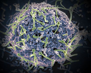 nih , dos medicamentos reducen el riesgo de muerte por ébola