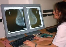 inteligencia artificial y radiólogos precisión en mamografías