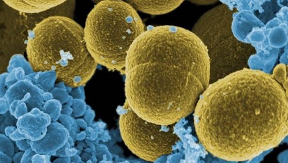 mecanismo que regula la actividad patogénica de la bacteria ‘Staphylococcus aureus’