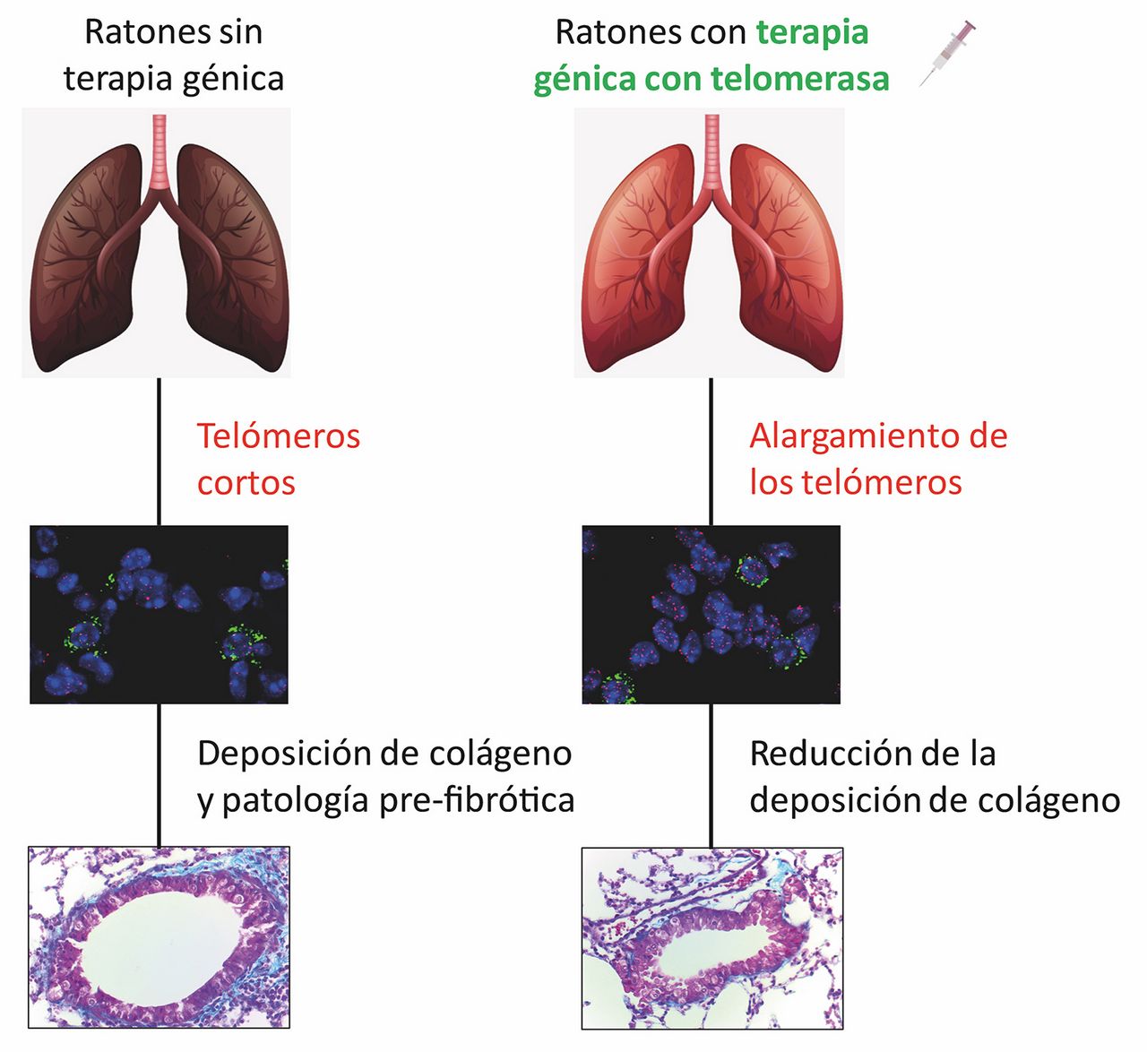Terapia génica contra la fibrosis pulmonar asociada al envejecimiento 