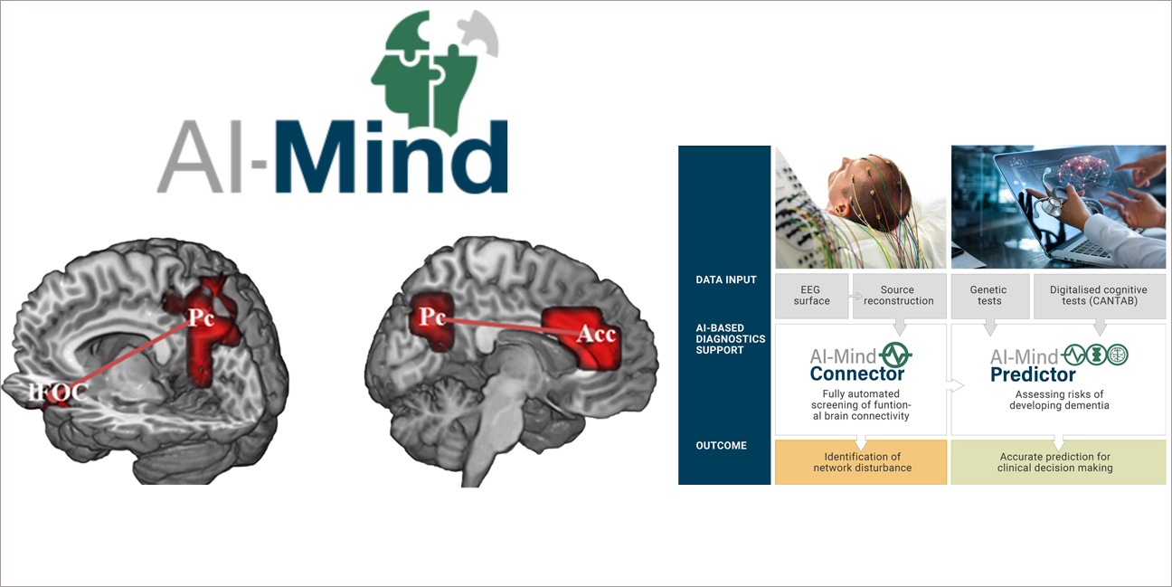 ucm inteligencia artificial para la prevención de la demencia