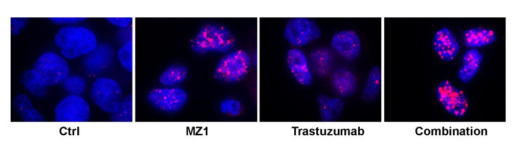 trastuzumab y MZ1