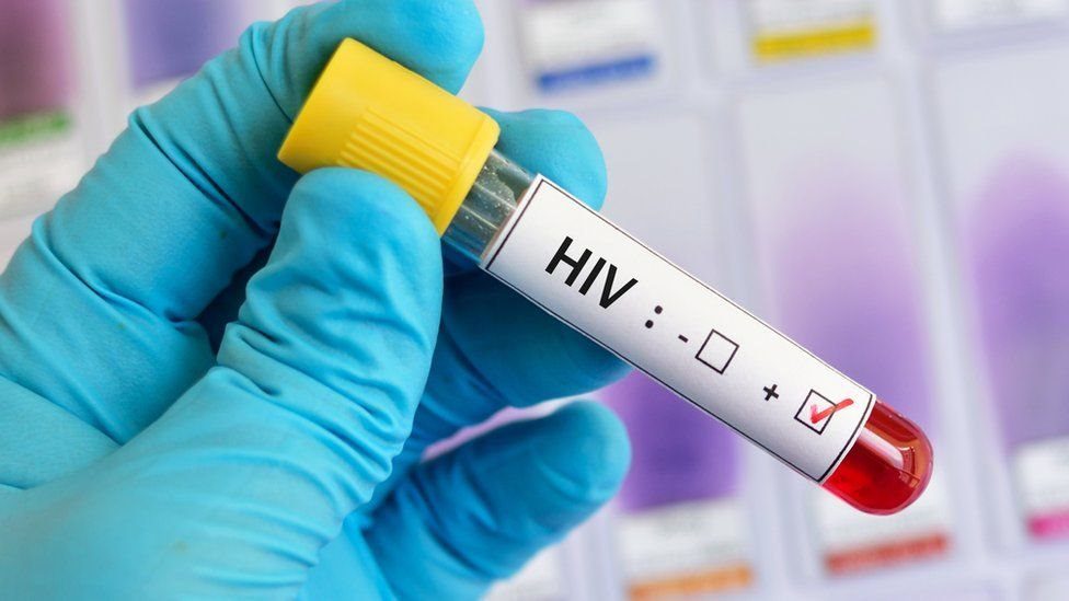 La vacuna contra el VIH da un gran paso6
