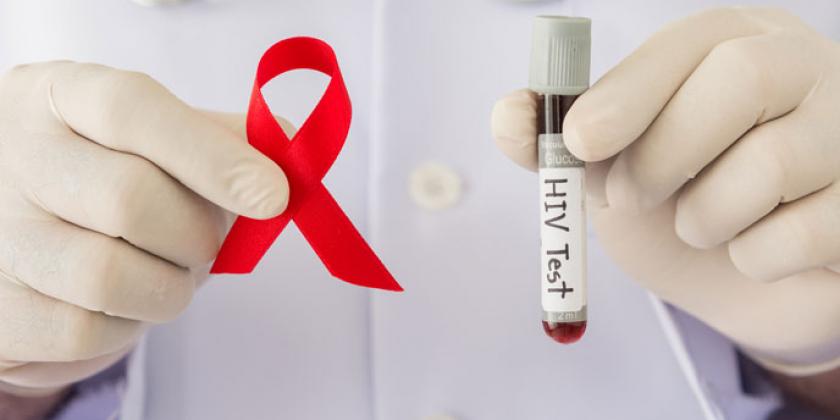 La vacuna contra el VIH da un gran paso1