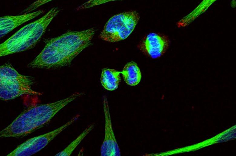 Imagen confocal de celulas en mitosis Ignacio Cabral CIB 1