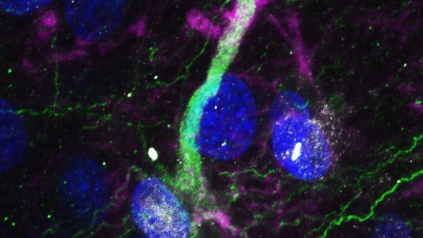 Existencia de celulas madre en el cerebro humano2
