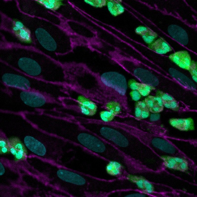 Neutrophils on endothelial cells 1