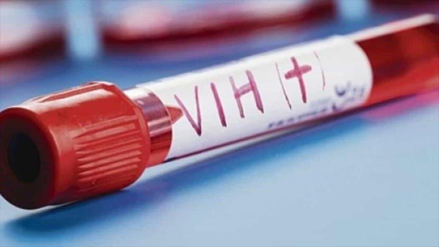 Segundo paciente con VIH que suprime el virus1