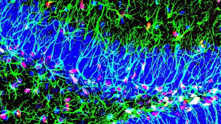 Nuevo mecanismo activar celulas madre cerebro adulto4