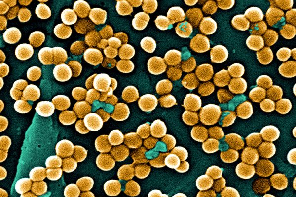 El estafilococo descubierta su resistencia a los antibioticos1