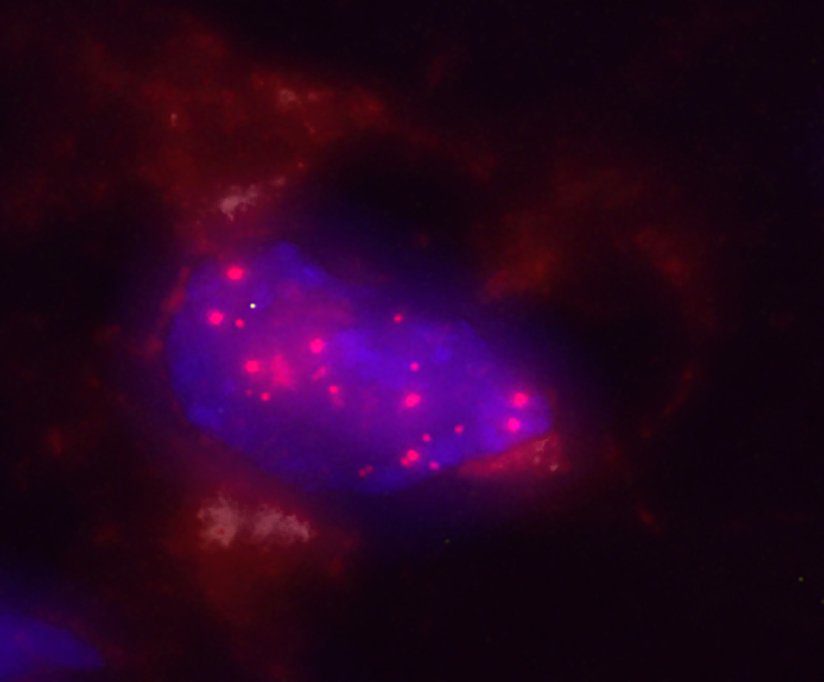 Nucleo de una celula pancreatica en color azul en el que se observan Bacteroides en rojo uno de los microorganismos identificados en el trabajo CNIO copia