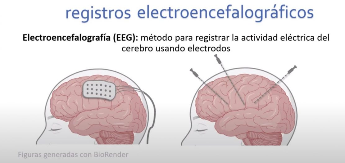 Electroencefalograma