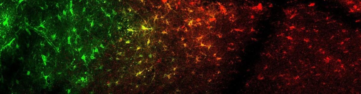 Neurona astrocito ayuda entender depresion y adicciones3