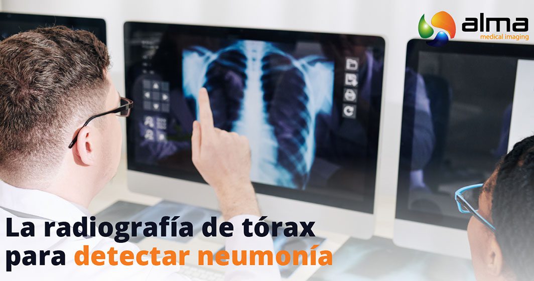 radiografia torax para detectar neumonia
