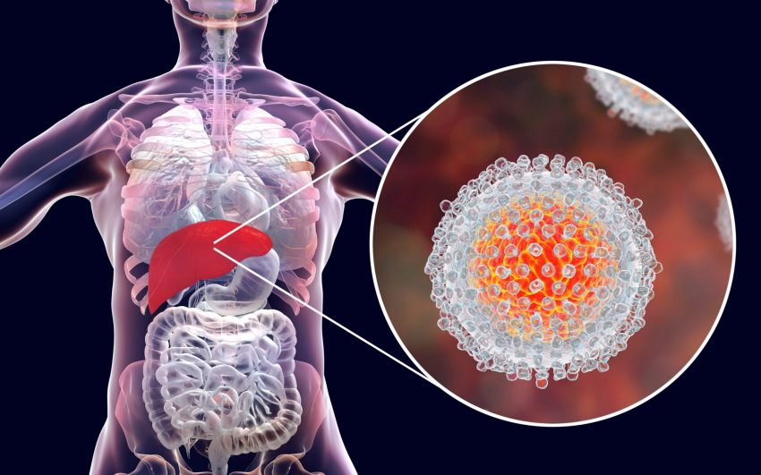 Biosensor detector ultrasensible Hepatitis C5