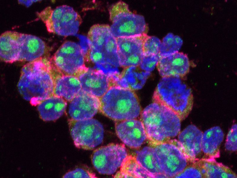 Nanocapsulas con control remoto localiza efecto quimioterapias1